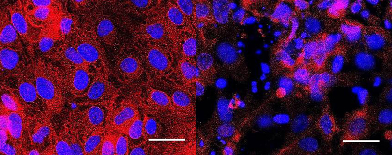 Normal cells (left) and cells treated with aristolochic acid (right), a banned compound.