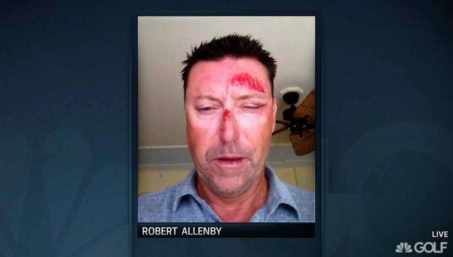 Australian golfer Robert Allenby was recovering on Saturday from facial injuries after he was kidnapped, beaten, robbed and dumped in a park in Honolulu. -- PHOTO:&nbsp;TWITTER/GOLFCHANNEL