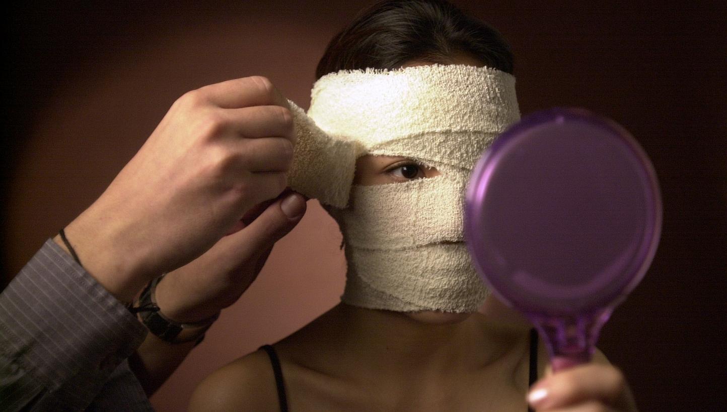 Chinese businesswoman Chen Yili paid a South Korean hospital thousands of dollars to reshape her face in the hope she would look more like the glamourous stars she saw on television.&nbsp;Instead, she says she was disfigured by the operation. -- PHOT