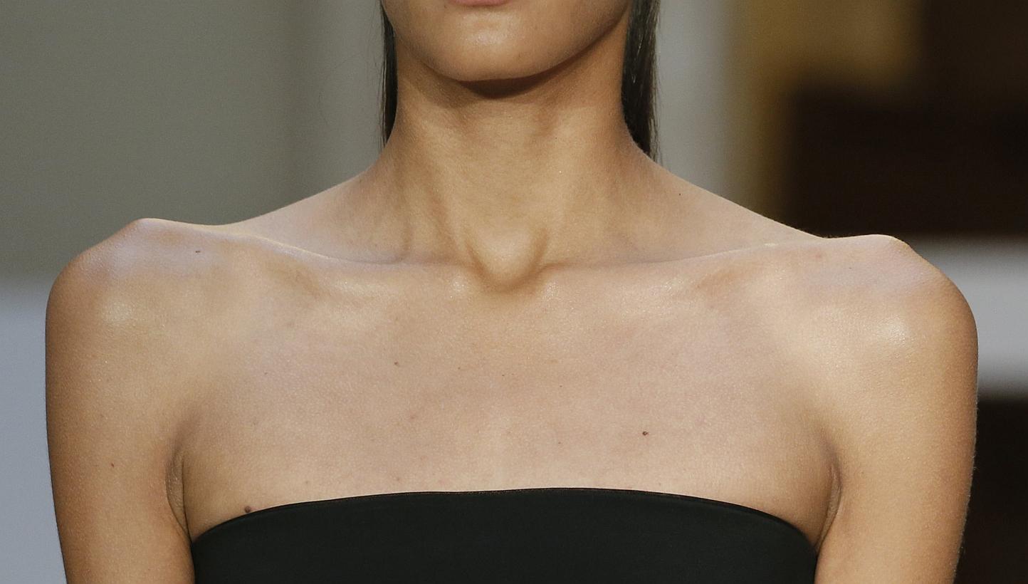 MPs in France voted Thursday to take aim at "pro-anorexia" websites. Inciting people to extreme thinness could be punishable by a year in prison and a fine of 10,000 euros (S$14,710) in the country. -- PHOTO: REUTERS-- PHOTO: REUTERS