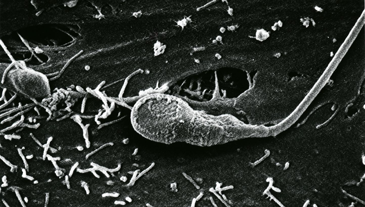 The Kallistem laboratory in the eastern French city of Lyon this week announced they had obtained "complete human spermatozoa in vitro" (not pictured), a world first which scientists have laboured towards for some 15 years.&nbsp;-- PHOTO:&nbsp;ST FIL