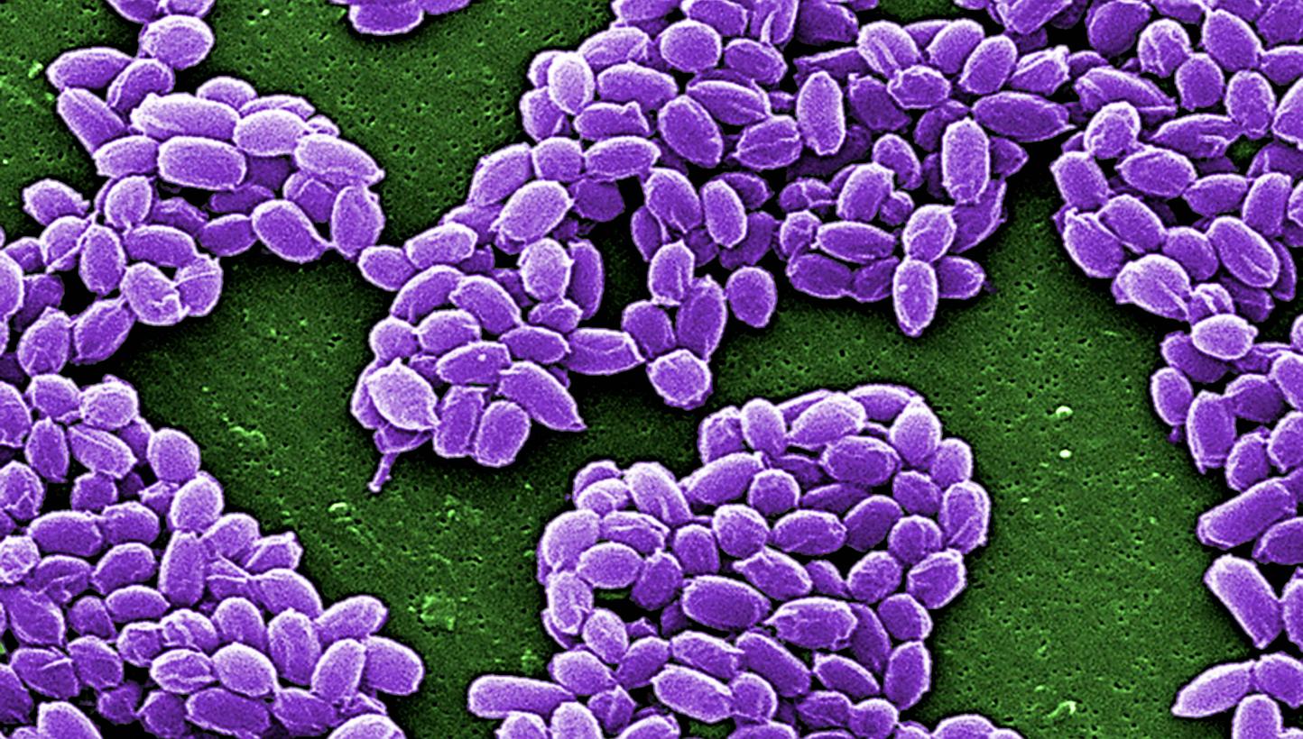 Spores from the Sterne strain of anthrax bacteria (Bacillus anthracis). -- PHOTO: REUTERS