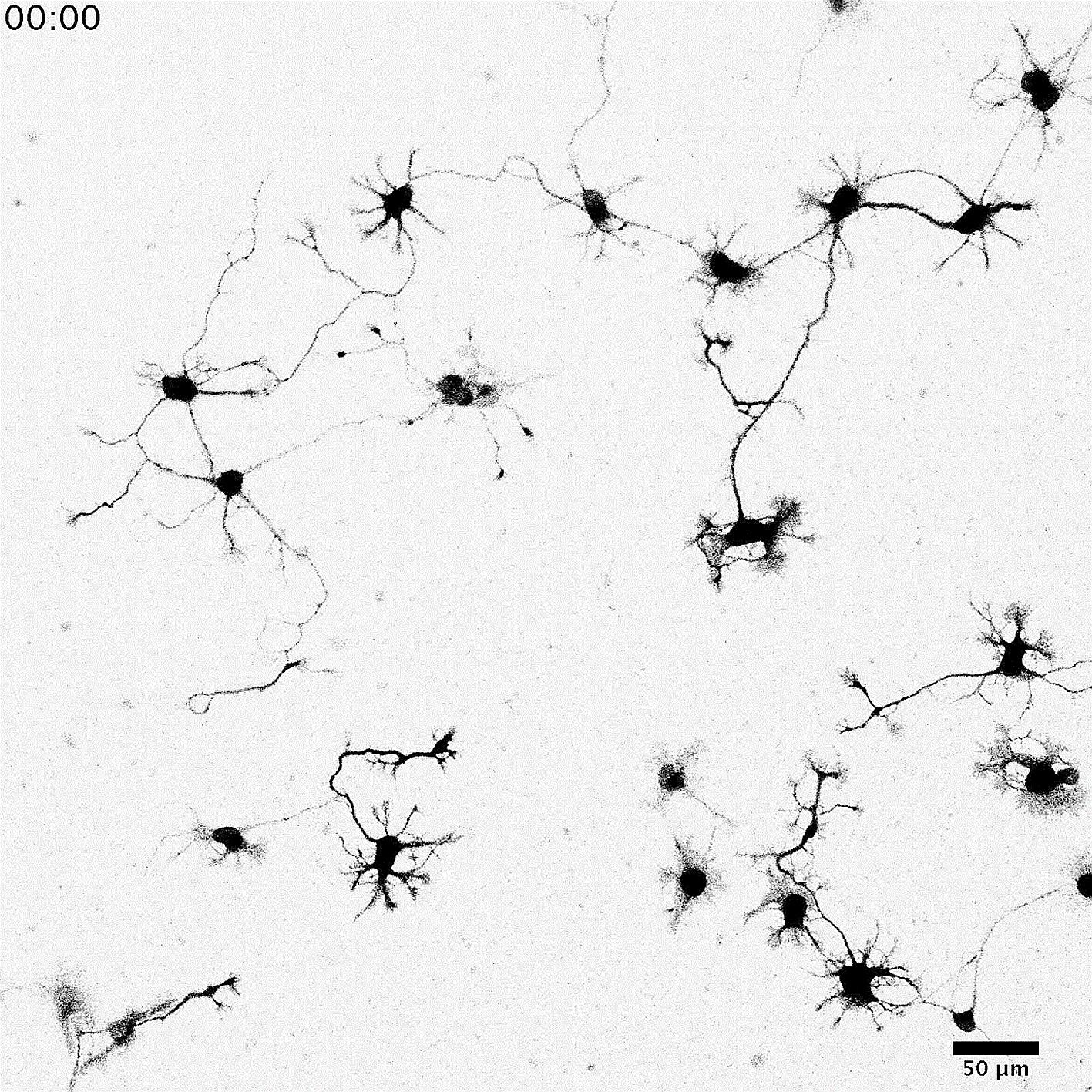 These live neurons, stained with a chemical dye called Neuron Orange, or NeuO, were captured at 20 times magnification under a widefield microscope. The dye is what allows neurons to be distinguished easily from other types of brain cells. NeuO is th