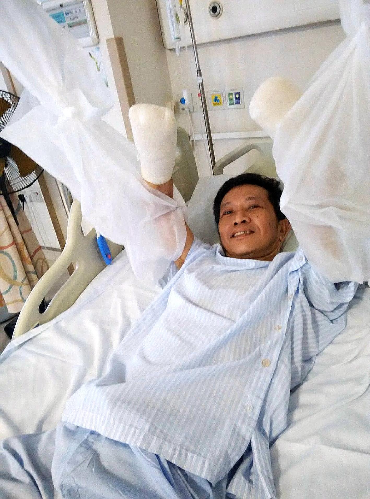 Mr Tan Whee Boon in good spirits after surgery yesterday. The food poisoning led to medical conditions requiring his hands and feet to be amputated.
