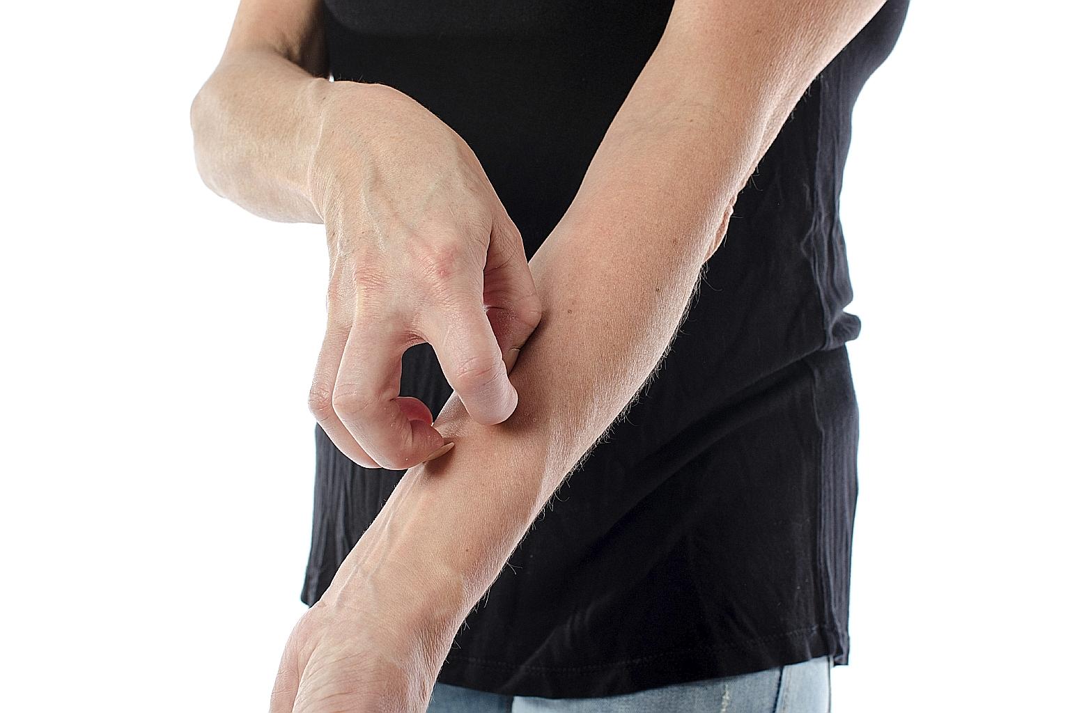 Eczema is a common chronic dry skin condition. In mild cases, the skin is scaly, red and itchy. If it is severe, the skin can weep, crust, blister or bleed. Scratching can cause the skin to split and bleed, leaving it open to infection.