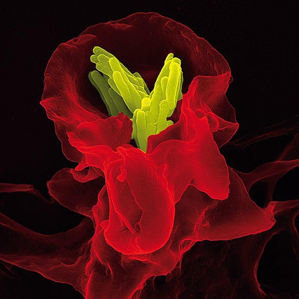The human immune system in action. This coloured scanning electron microscope image shows a white blood cell (dyed red) in the act of destroying tuberculosis bacteria (yellow).