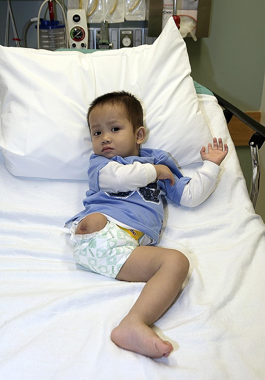 Thien Nhan back in 2009. The abandoned child was mauled by a wild dog.