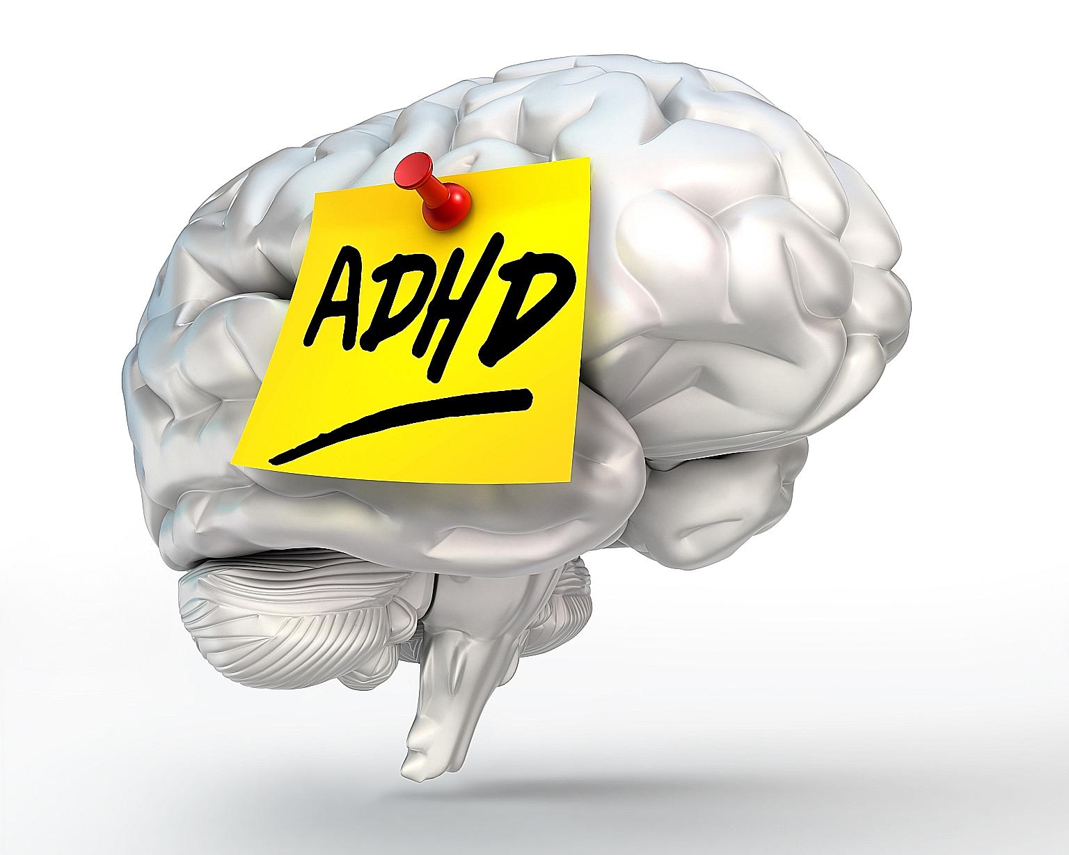 ADHD is caused by a delay in maturation involving parts of the brain responsible for attention control and behaviour inhibition.
