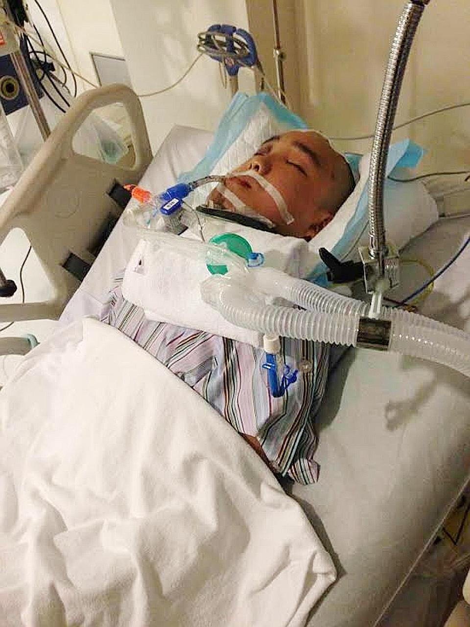 Mr Lee was in a coma when he was taken to hospital. His chin bone was broken and cheek bone cracked.