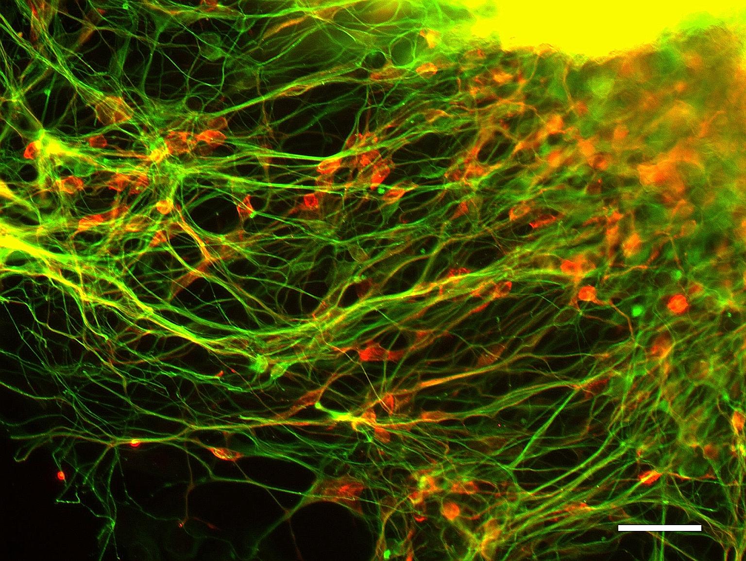 Neurons grown from "induced pluripotent stem cells" derived from the lining of a human umbilical cord, by a team of local scientists who think that such regeneration of neurons could be used to reverse the effects of Parkinson's.