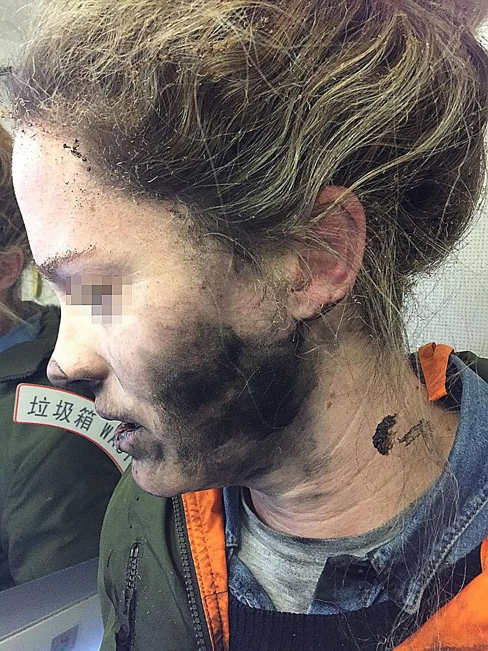 The battery-operated headphones exploded while the woman was listening to music and dozing about two hours into her flight from Beijing to Melbourne on Feb 19.