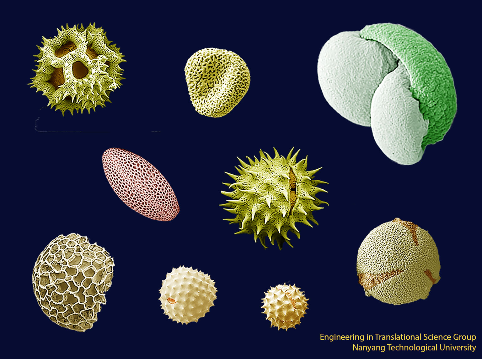 Pollen is thought of as the diamond of the plant world as it is practically indestructible. This image is of pollen grains from various plants including the sunflower, pine and dandelion. Pollen or flower sperm comes in a variety of shapes and sizes,
