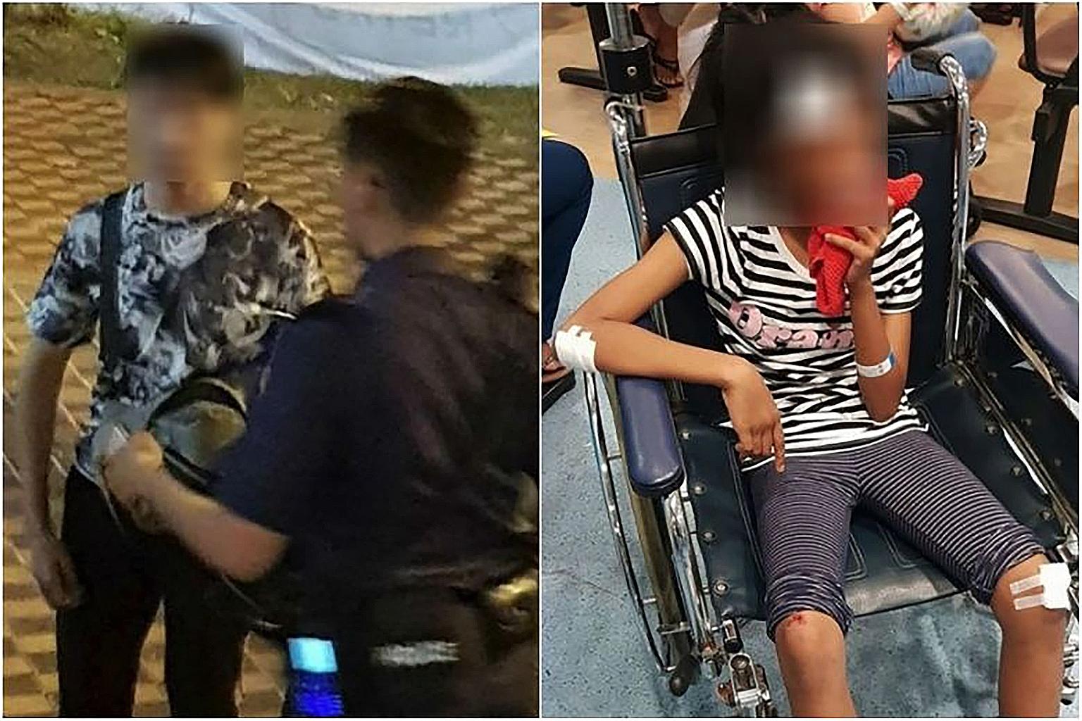 The 11-year-old girl needed stitches to her gums, and had abrasions on her head, face, elbow and knees after she was hit by an e-scooter.