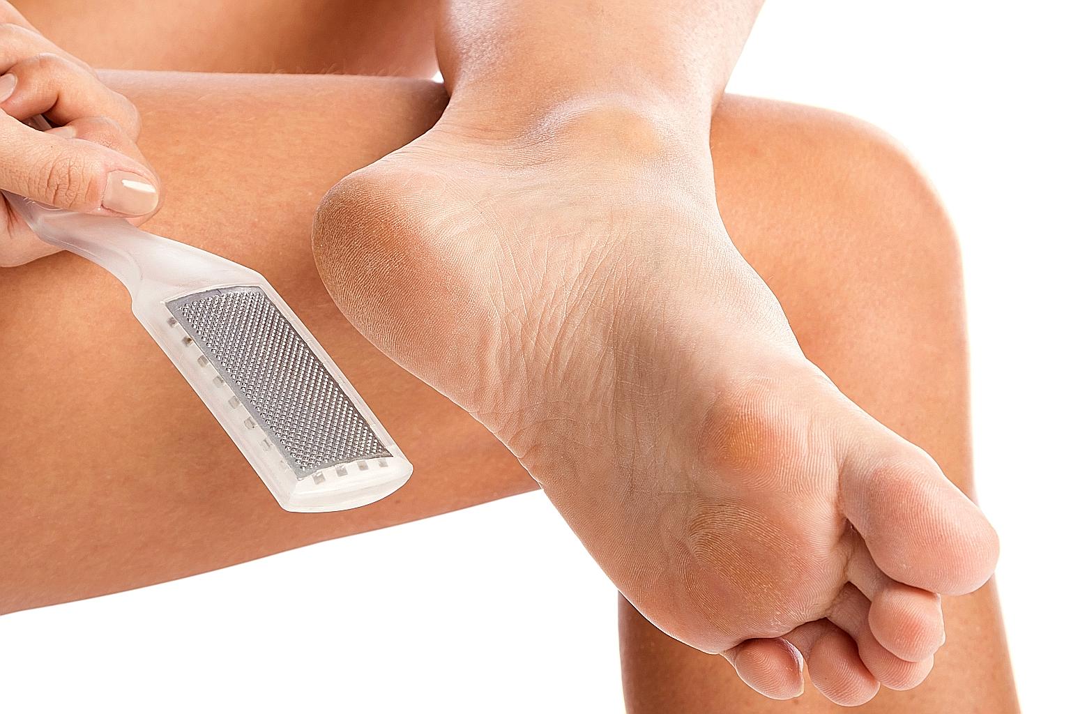 Using a callus file is the safer way to remove thickened skin. But do not file too aggressively and, if unsure, seek help from a podiatrist.