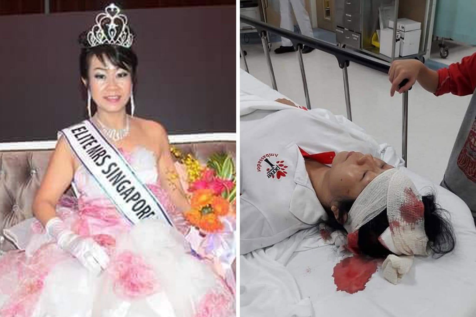 Madam Cassandra Ho, who was crowned Elite Mrs Singapore Asean in 2016 (far left), was taken to Tan Tock Seng Hospital after she was hit by an e-scooter. She hurt her head and face (left) in the accident.