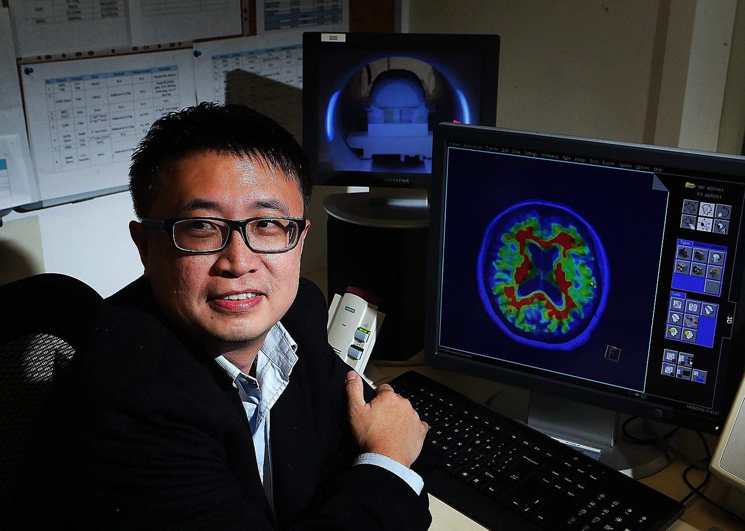 Assistant Professor Thomas Yeo with a magnetic resonance imaging scan of a human brain. The machine can be used to detect tumours or dementia. His main research interests include finding out how different people are vulnerable to mental disorders.