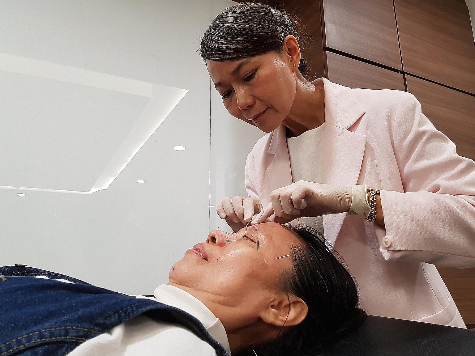 Madam Tan Hwa Moi undergoing acupuncture treatment as part of the clinical trial to treat dry eyes. The study was part of a three-year collaboration between the Singapore Eye Research Institute and Singapore Chung Hwa Medical Institution.