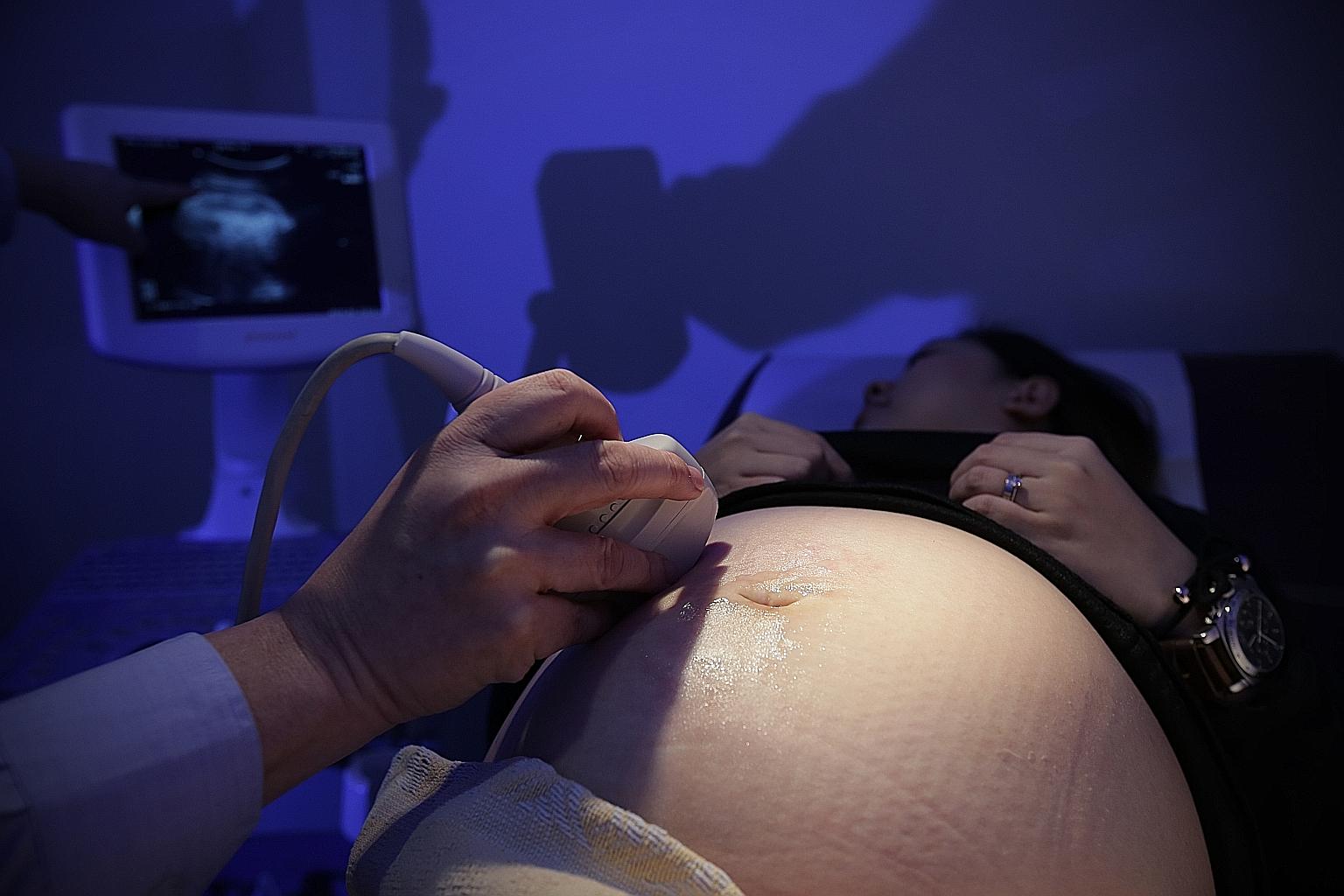 Singapore has one of the highest gestational diabetes rates in the world, with one in five births affected by it. In comparison, the International Diabetes Federation estimates that one in seven births worldwide is affected by the condition.