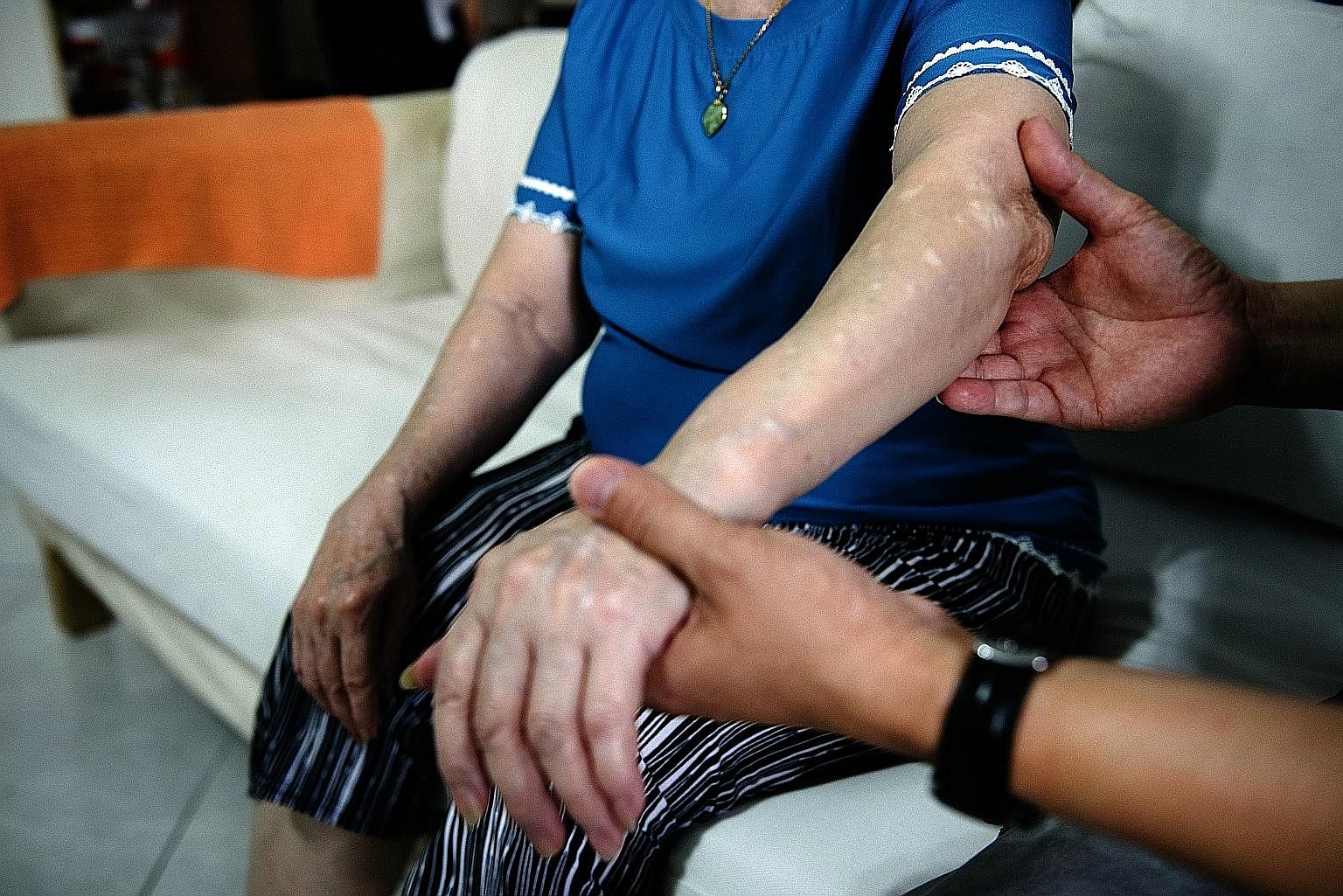Mr Chua Juay Peng showing the marks on his mother Low Meow Luan's arms that came from her burning herself with joss sticks. It was her way to get rid of the "insects" she believed were roaming freely on her body. With treatment, Madam Low has improve