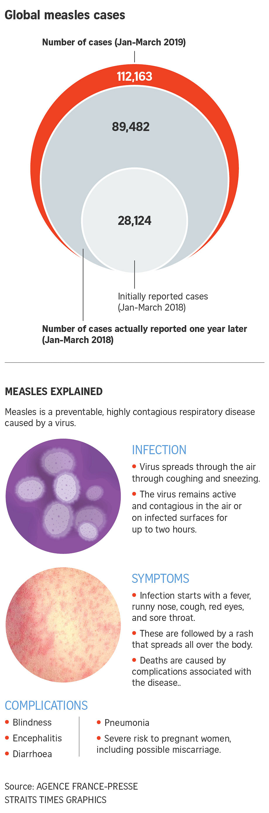 Global Measles Cases Up 300 Per Cent Year-on-year | The Straits Times