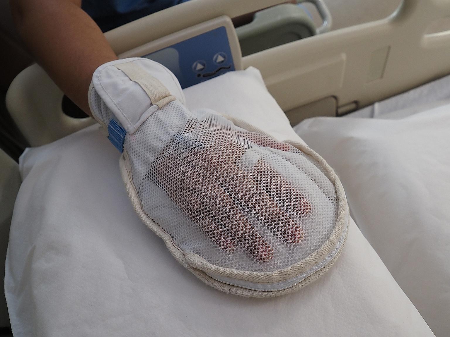 The new mitten has a zip to allow nurses to access a patient's fingers to take blood tests or check his vital signs.