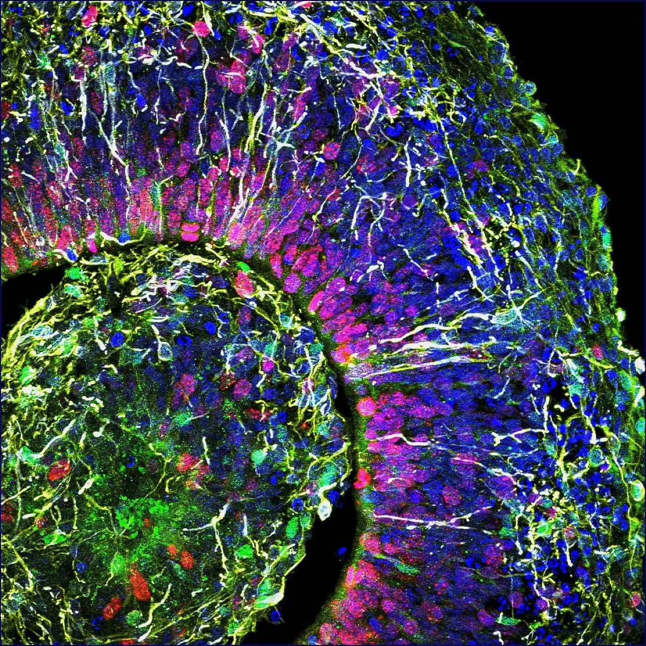 A cross-section of a brain organoid showing the initial formation of a cortical plate. Each colour marks a different type of brain cell. 