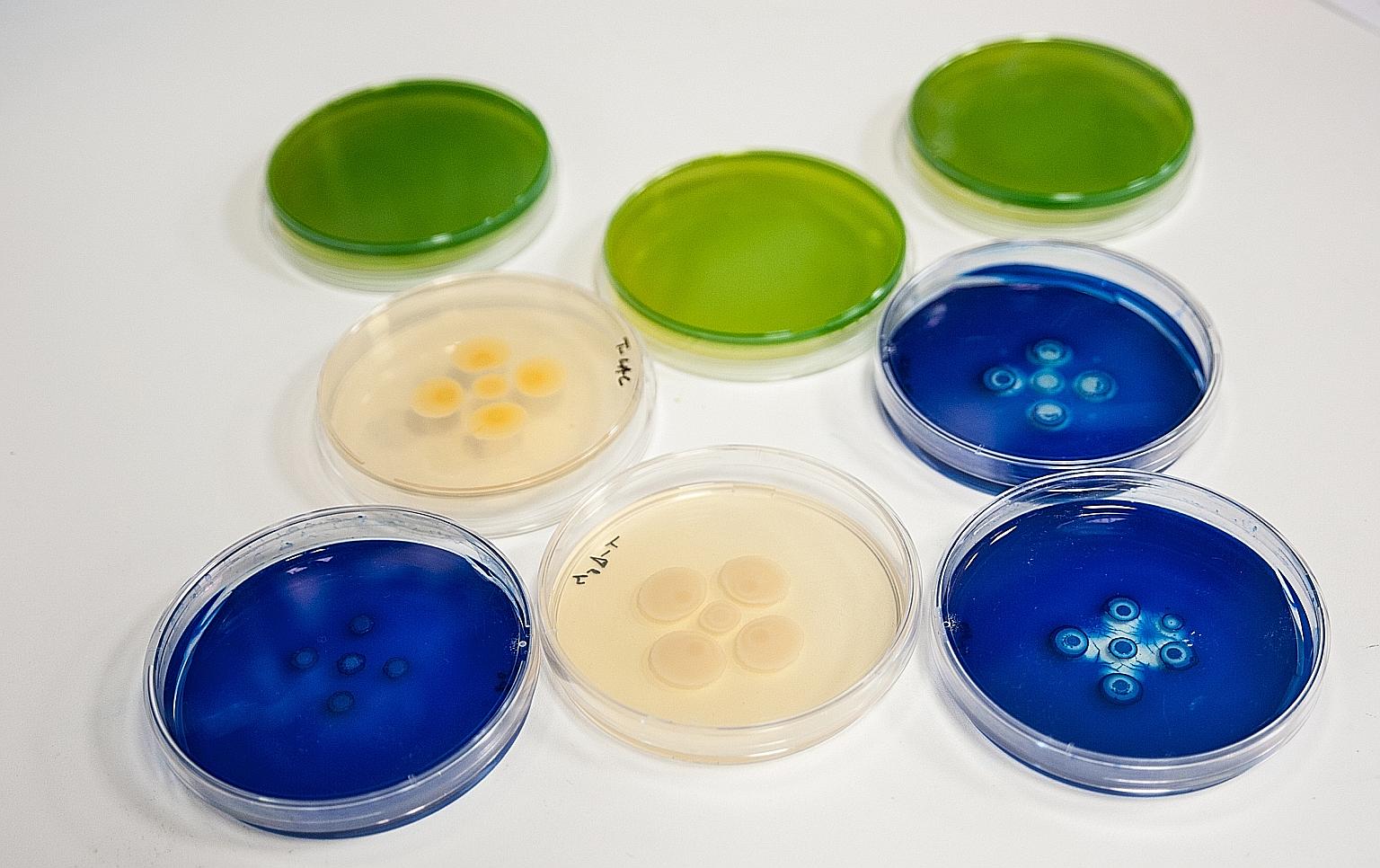 Superbugs cultivated in a laboratory. The global spread of superbug infections is frightening, and the emergence of new resistance mechanisms and the spread of resistance to common infections are now a daily reality for us all, says the writer.