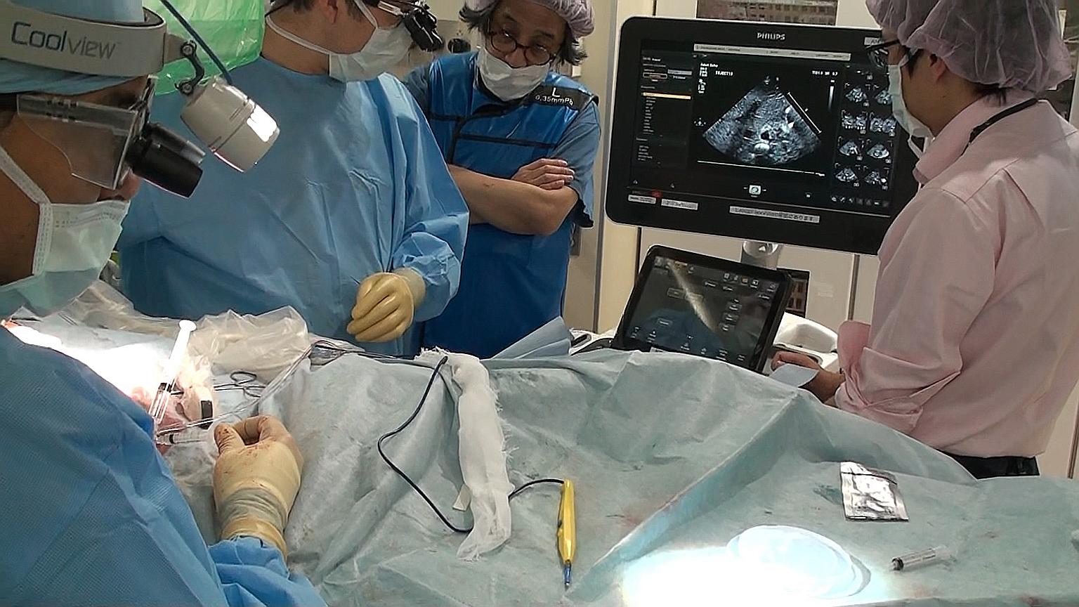 A team at work during a liver cell transplant in Tokyo. Doctors successfully transplanted liver cells into a baby with urea cycle disorder, raising hopes for new treatment options for infants.