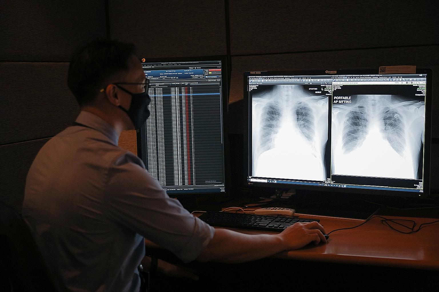Dr Ting Yong Han, consultant in diagnostic radiology (clinical) at TTSH, looking at a chest X-ray of a Covid-19 patient that was flagged by the AI tool, RadiLogic, which can analyse an image within three seconds.