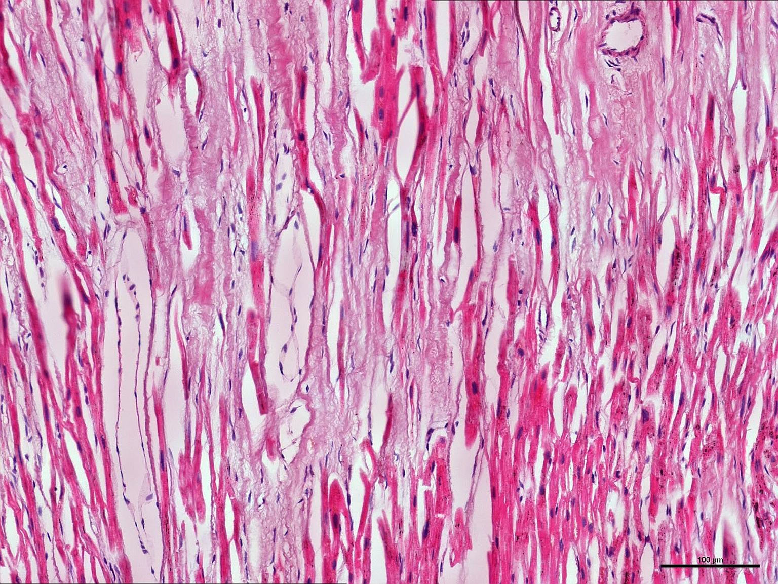 A cross-sectional view of the heart muscle. The NUS team's gene map took about five years to develop.