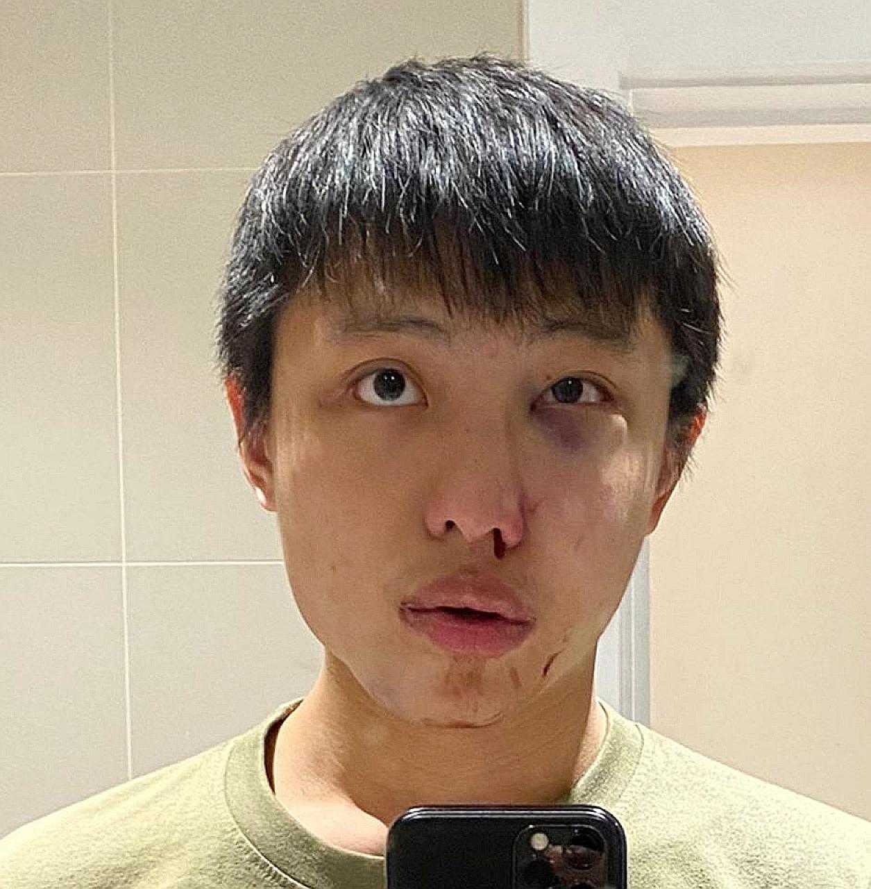 Singaporean Jonathan Mok was a student in London when he was beaten up in Oxford Street in an unprovoked attack last year.
