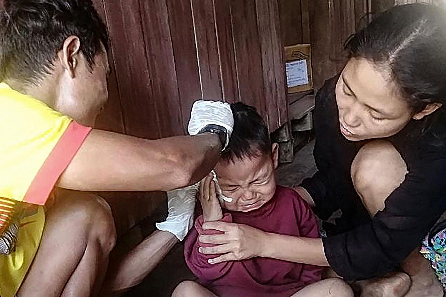 Saw Ta Eh Ka Lu Moo Taw, who is almost three years old, receiving medical treatment in a village in eastern Myanmar's Karen State after he was injured by shrapnel while sitting on the lap of his father, who was killed during an air strike in the area