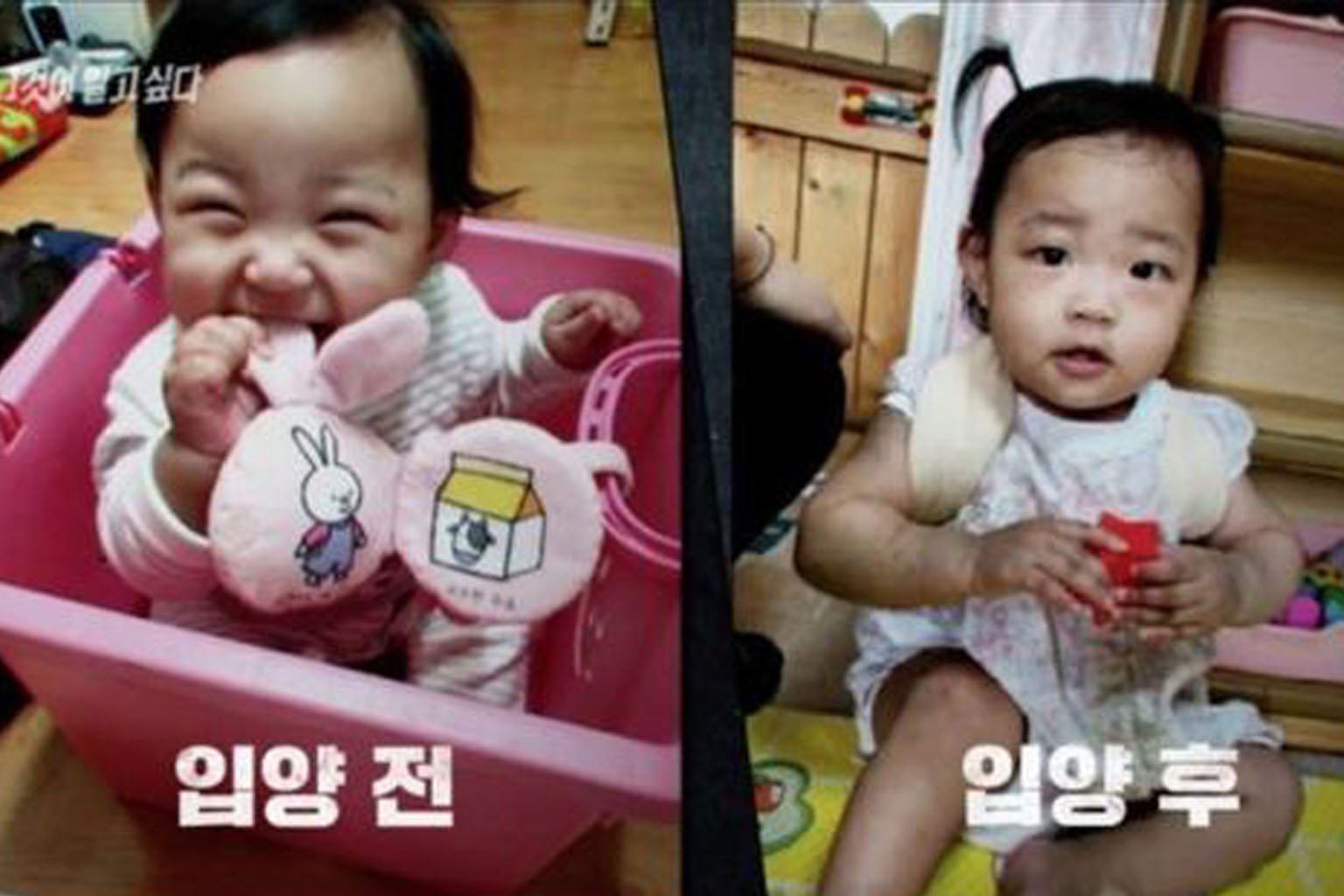 In screenshots from South Korean TV network SBS' investigative report on the 16-month-old girl aired yesterday, a photo of Jeong-in before her adoption is shown on the left and a post-adoption picture of her is shown on the right.