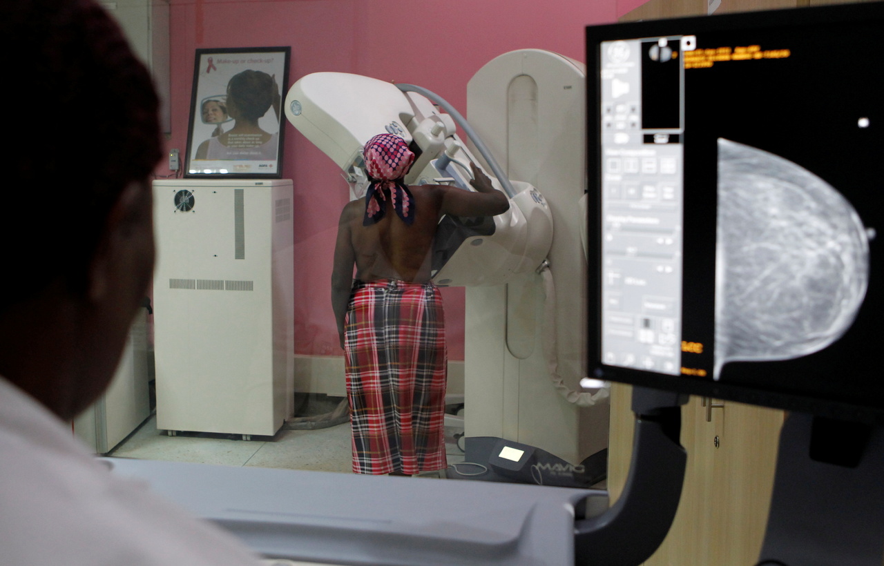 Earlier breast cancer screening would narrow mortality gap for black ...