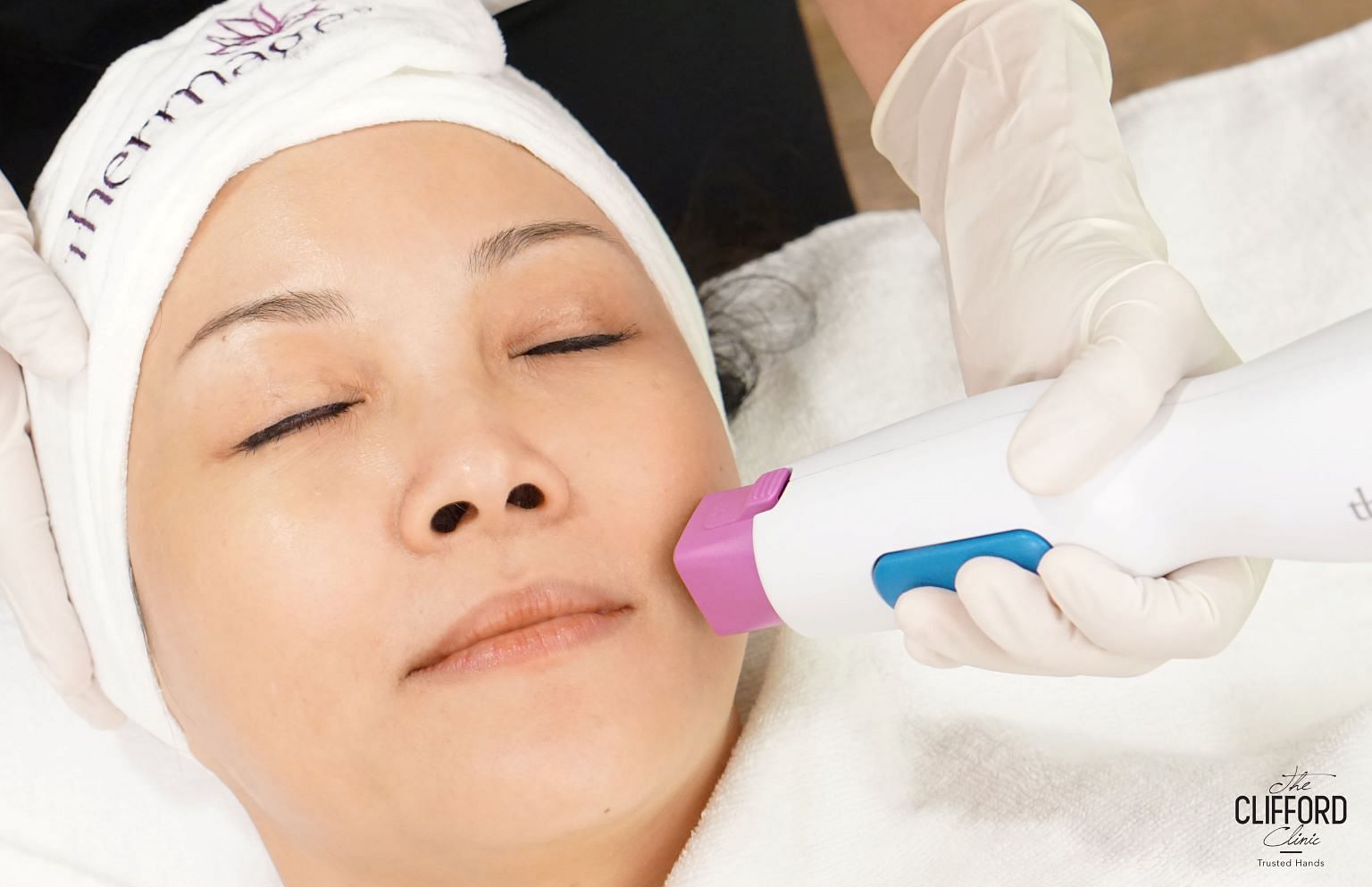 thermage flx treatment