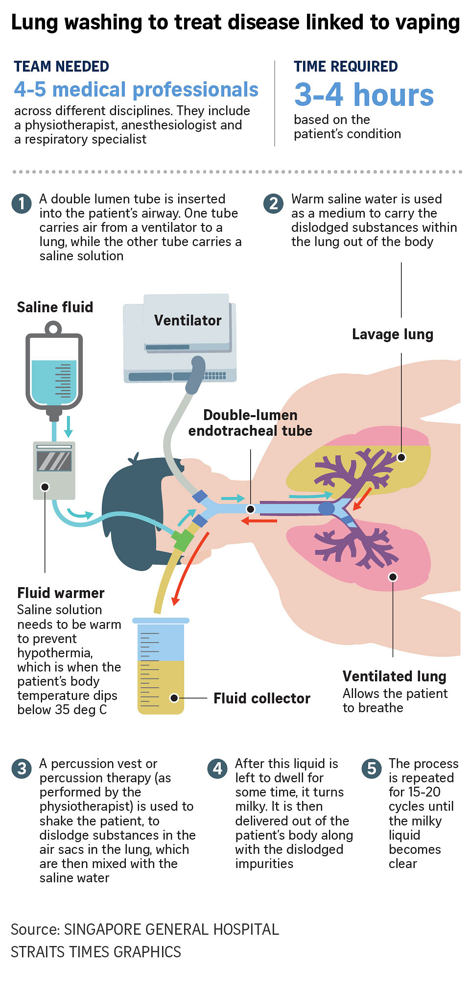 Former vape addict needed lung washing procedure twice after