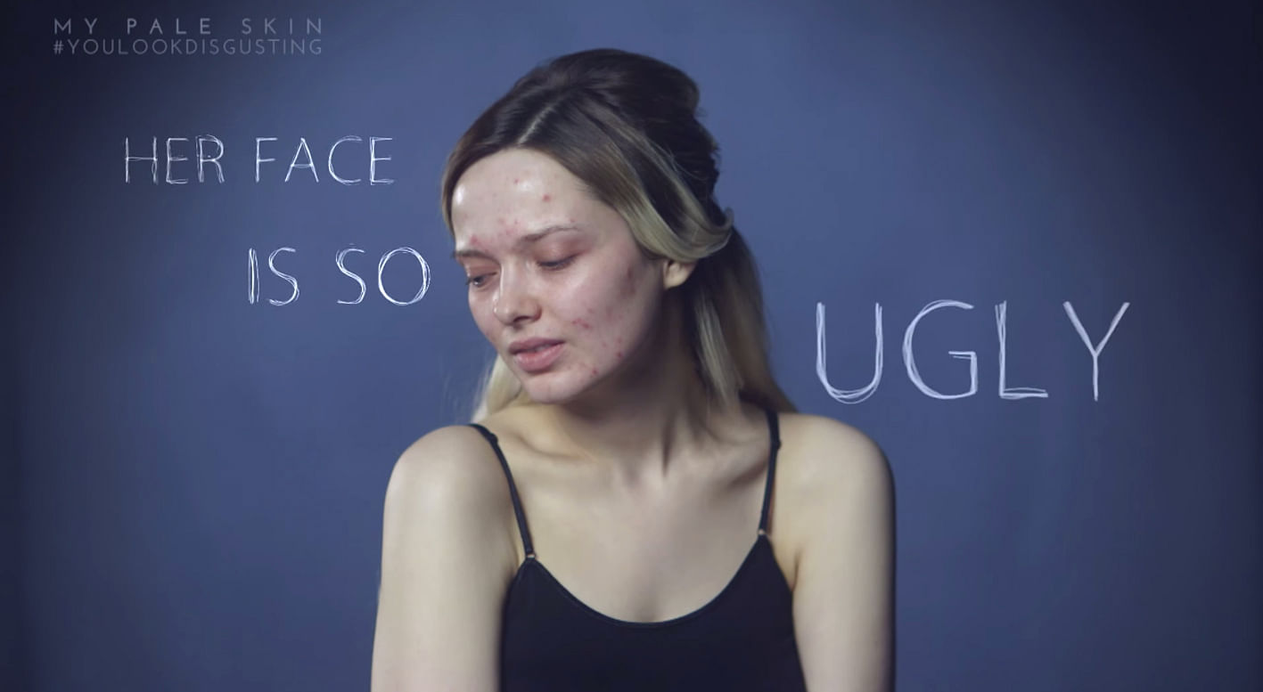 Beauty blogger Em Ford posted a video showcasing negative comments that she received when she did not have makeup on. 