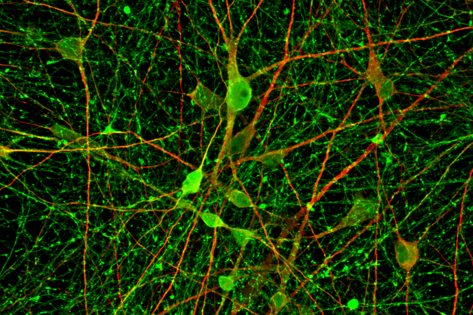 Neurons showing up green and red under the microscope with the help of immunostaining - a dyeing process which helps researchers from Duke-NUS Medical School, National Neuroscience Institute and A*Star's Genome Institute of Singapore identify the ner
