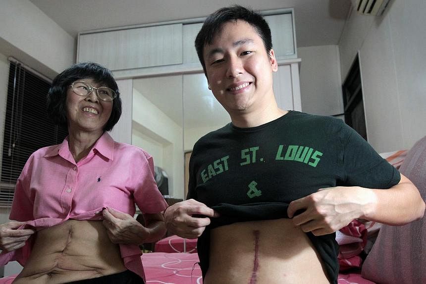 The only reminders of the grim days pre-surgery are the twin scars branded from chest to abdomen on mother and son.