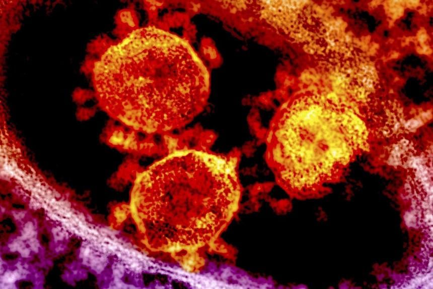 Particles of the Middle East respiratory syndrome (MERS) coronavirus that emerged in 2012 are seen in an undated colorized transmission electron micrograph from the National Institute for Allergy and Infectious Diseases (NIAID). An Illinois man who h