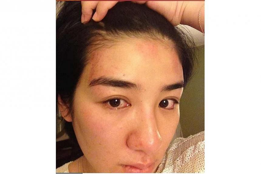 In an escalating marital dispute, Overheard 3 actress Huang Yi has denied cheating on her husband and released photos as purported evidence that he hit her. -- PHOTO:&nbsp;HUANG YI/WEIBO