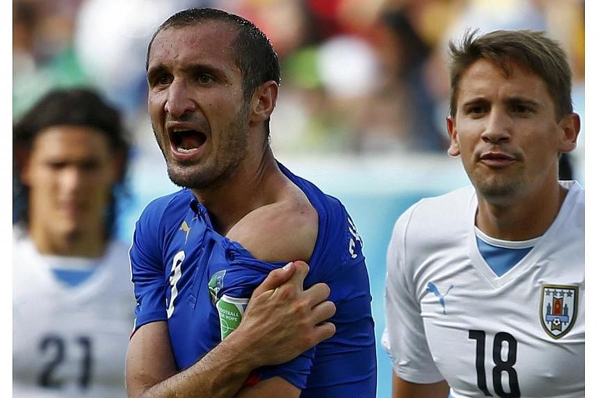 Italy's Giorgio Chiellini shows his shoulder, claiming he was bitten by Uruguay's Luis Suarez, during their 2014 World Cup Group D soccer match at the Dunas arena in Natal on June 24, 2014. &nbsp;-- PHOTO: REUTERS