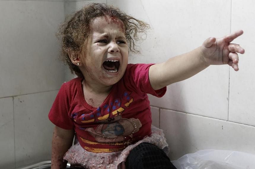 A Palestinian child shouts at al-Shifa hospital after Israeli forces shelled her house in Gaza City on July 18, 2014. -- PHOTO: AFP