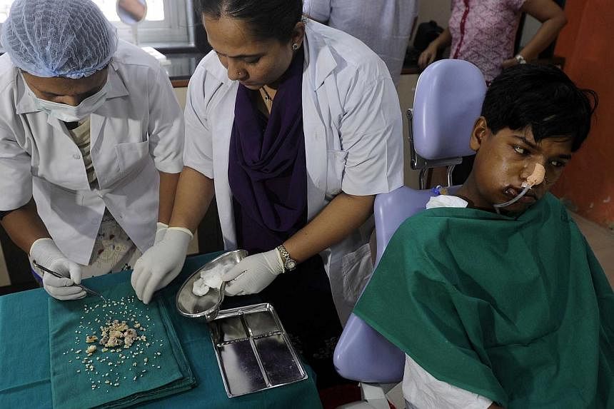Indian dentists operate on 17-year-old Ashik Gavai at JJ Hospital in Mumbai on July 22, 2014. -- PHOTO: AFP