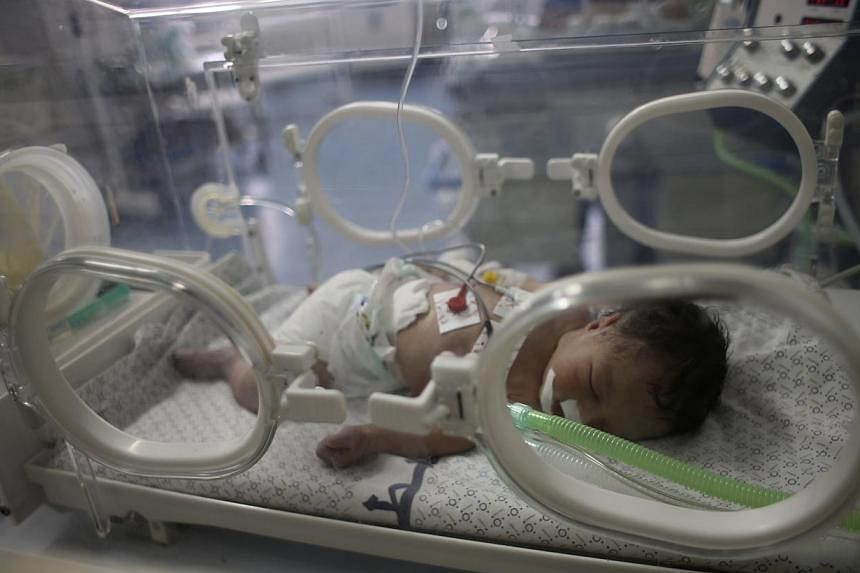 Palestinian baby girl Shayma Shiekh al-Eid lies in an incubator after doctors delivered her from the womb of her mother, whom medics said was killed in an Israeli air strike, at a hospital in Khan Younis in the southern Gaza Strip on July 27, 2014. -