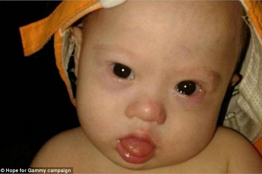 Well-wishers have raised nearly US$180,000 (S$224,400)&nbsp;for a baby reportedly left with his surrogate Thai mother after his Australian parents discovered he had Down’s Syndrome and returned home with his healthy twin sister.&nbsp;Australia's Im