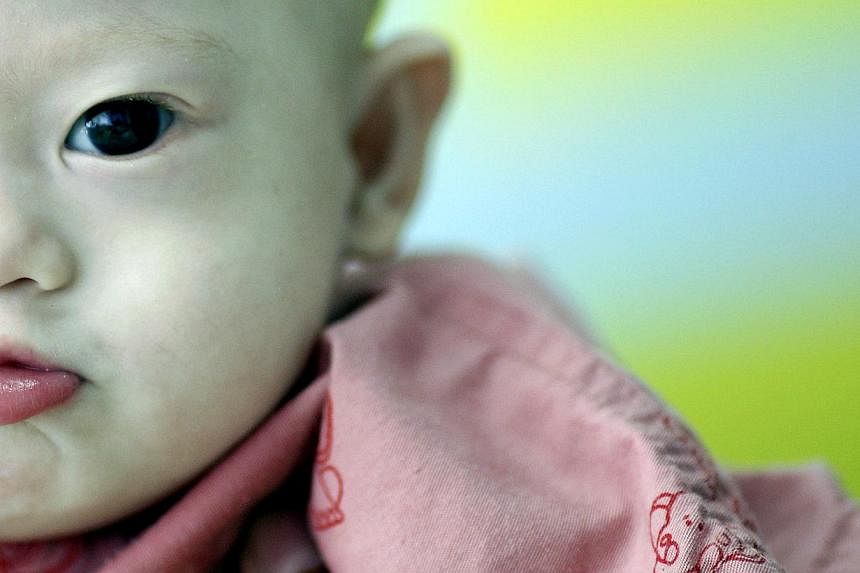 Gammy, a baby born with Down syndrome, at a hospital in Chonburi province on Aug 3, 2014. -- PHOTO: REUTERS