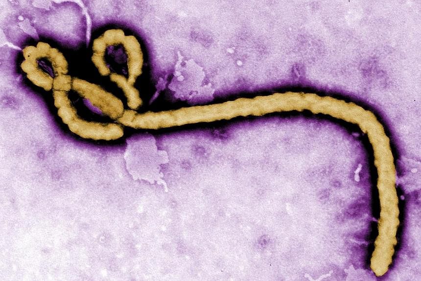 Some of the ultrastructural morphology displayed by an Ebola virus virion is revealed in this undated handout colorised transmission electron micrograph (TEM) obtained by Reuters on Aug 1, 2014. The Nigerian woman who was sent from Gleneagles Hospita