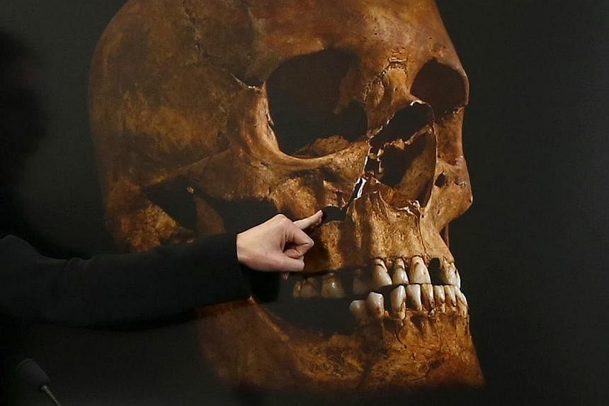 Project osteologist Jo Appleby points out the damage to a skull, believed to be that of Richard III, during a news conference in Leicester, central England, on Feb 4, 2013. -- PHOTO: REUTERS