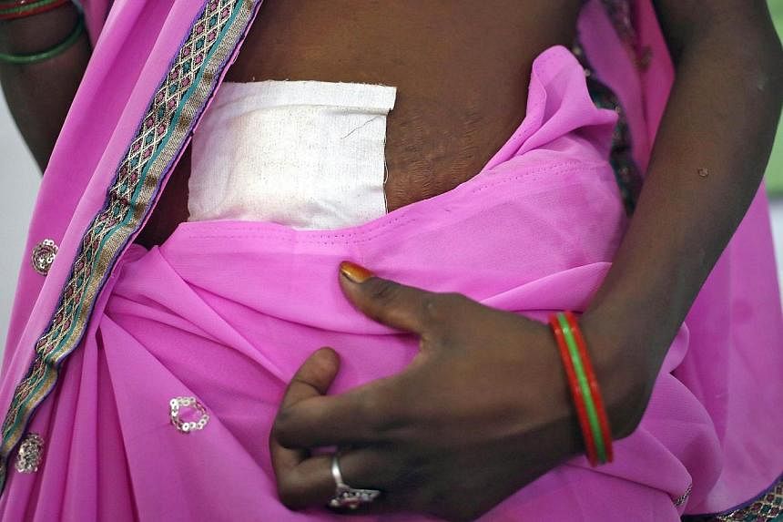 &nbsp;A woman, who underwent sterilization surgery at a government mass sterilisation "camp", walks to sit in a hospital bed at a district hospital in Bilaspur, in the eastern Indian state of Chhattisgarh, on Nov 13, 2014.&nbsp;India has defended a s